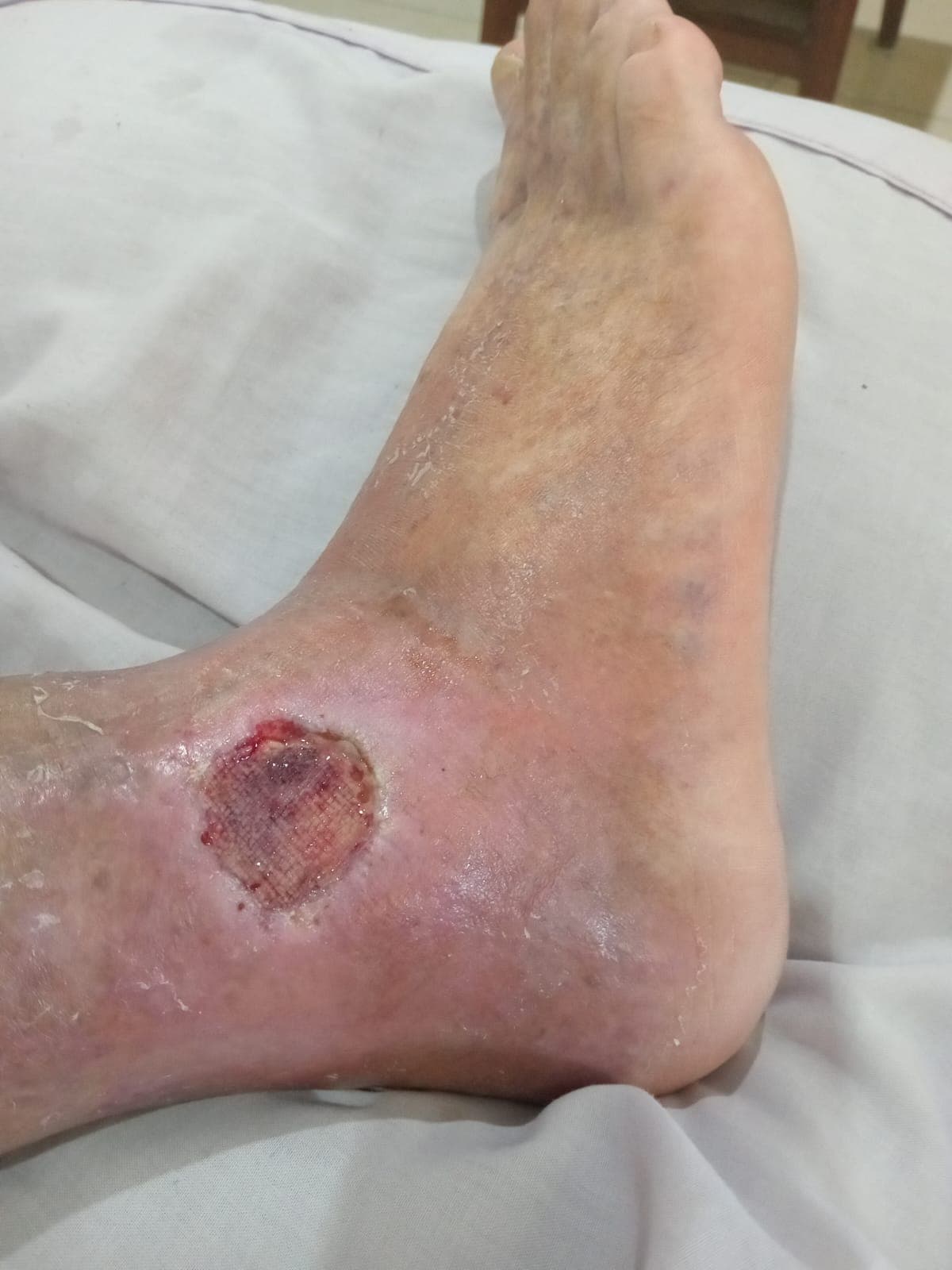 Pengobatan hari ke-12