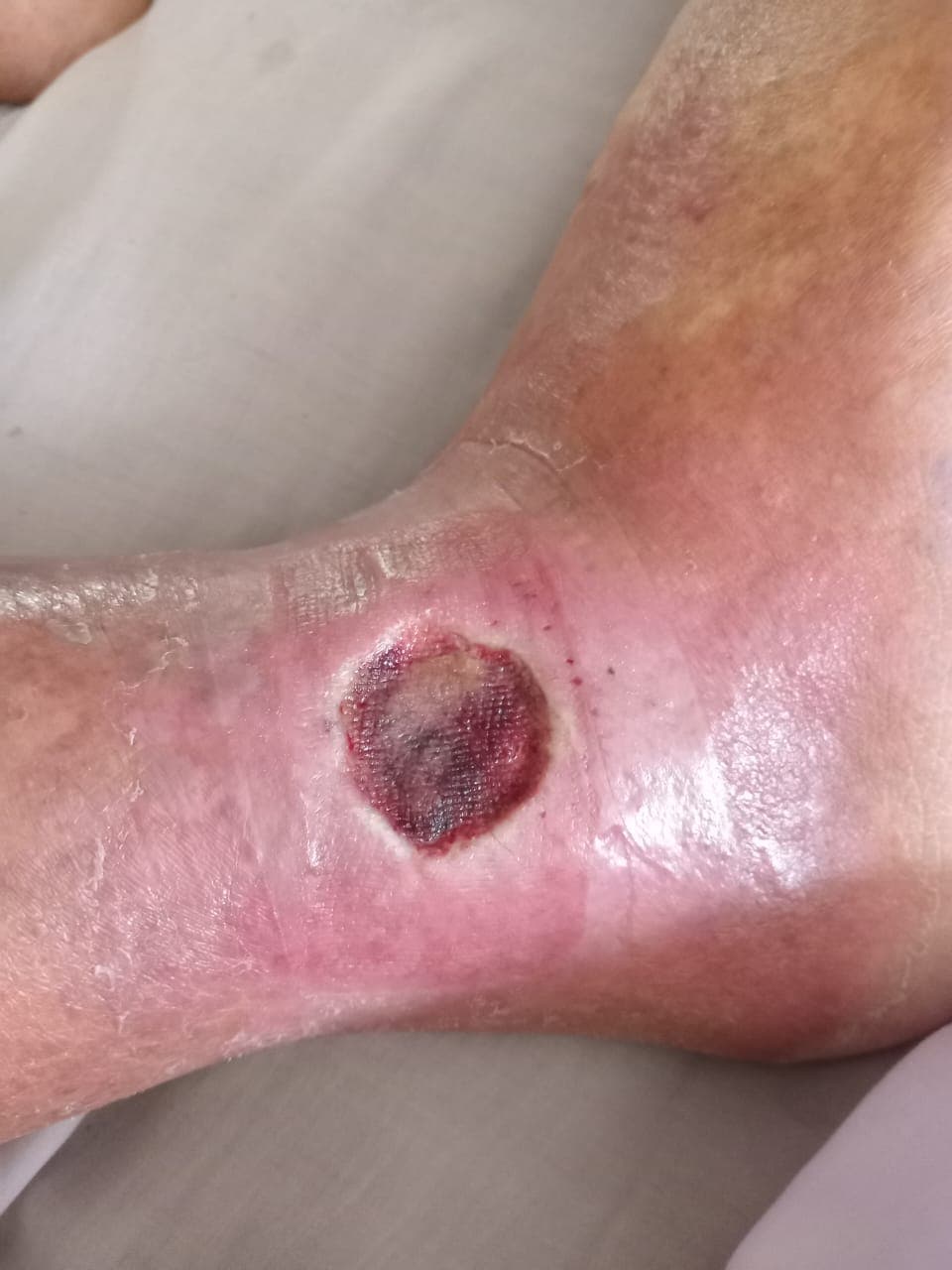 Pengobatan hari ke-15