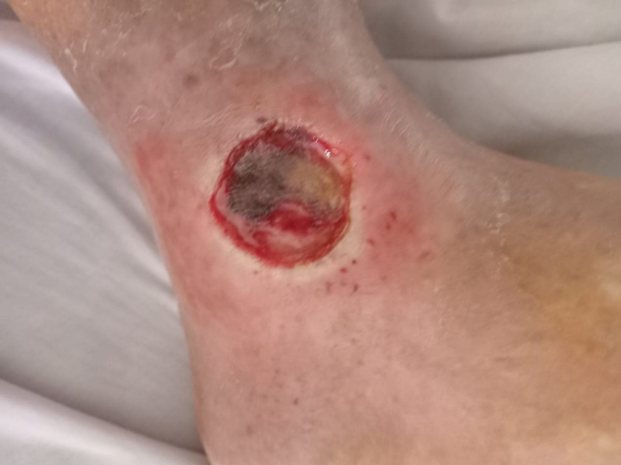 Pengobatan hari ke-16