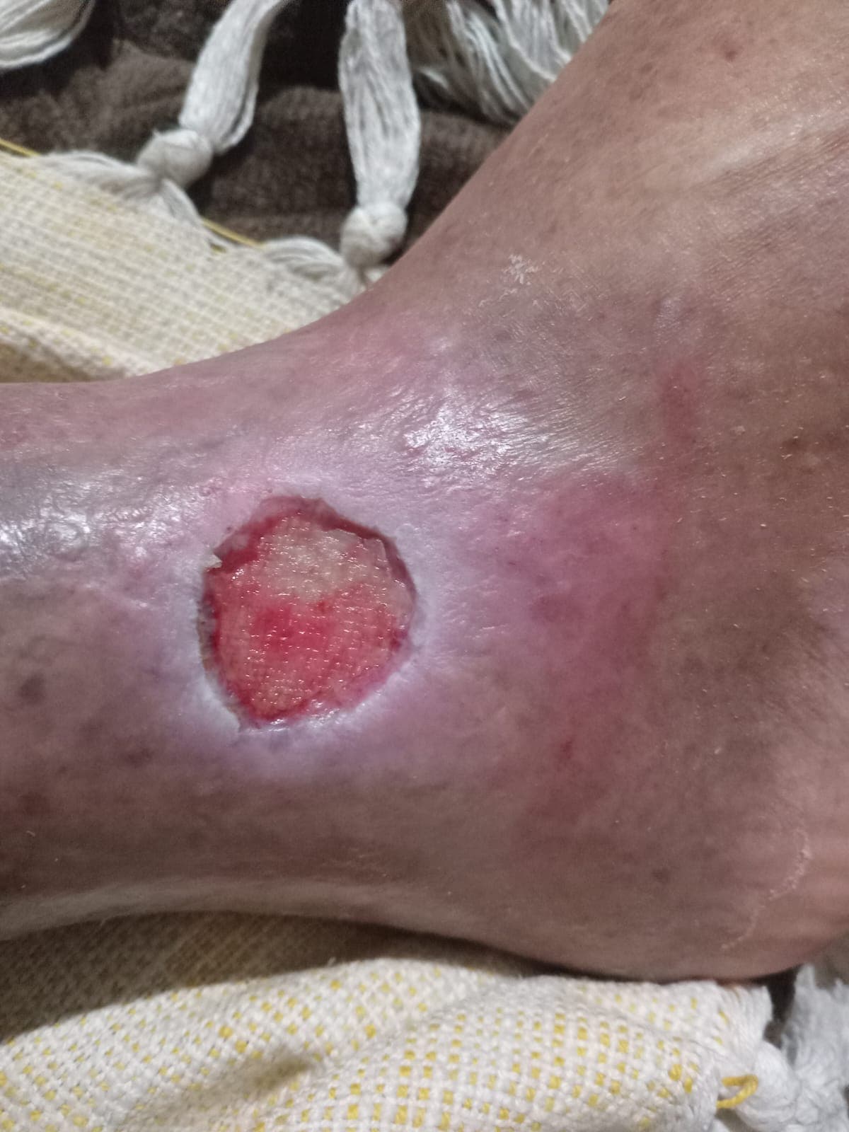 Pengobatan hari ke-4