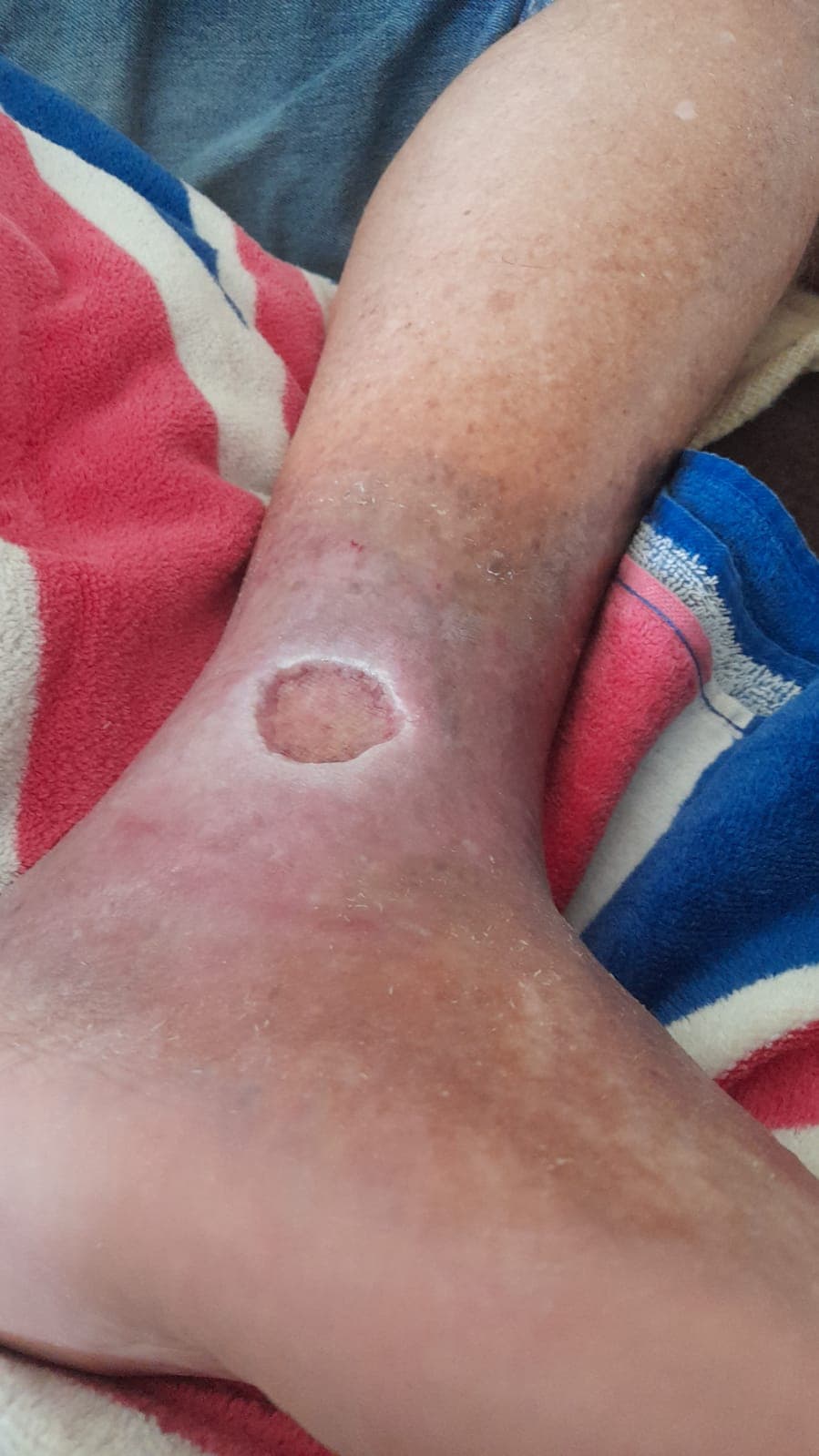 Pengobatan hari ke-5