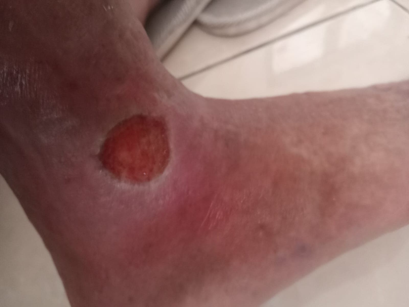 Pengobatan hari ke-6