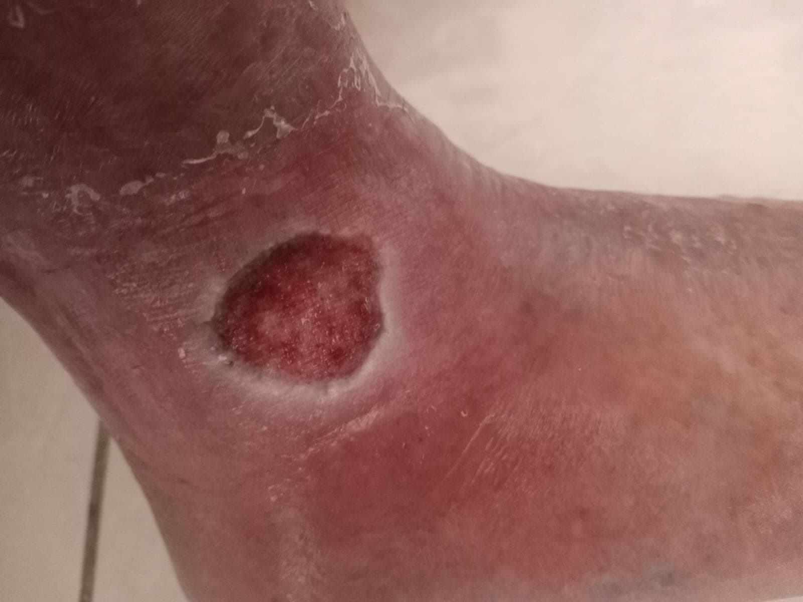 Pengobatan hari ke-7