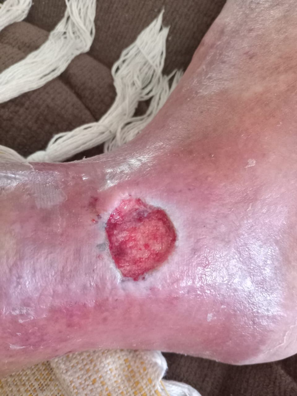 Pengobatan hari ke-8