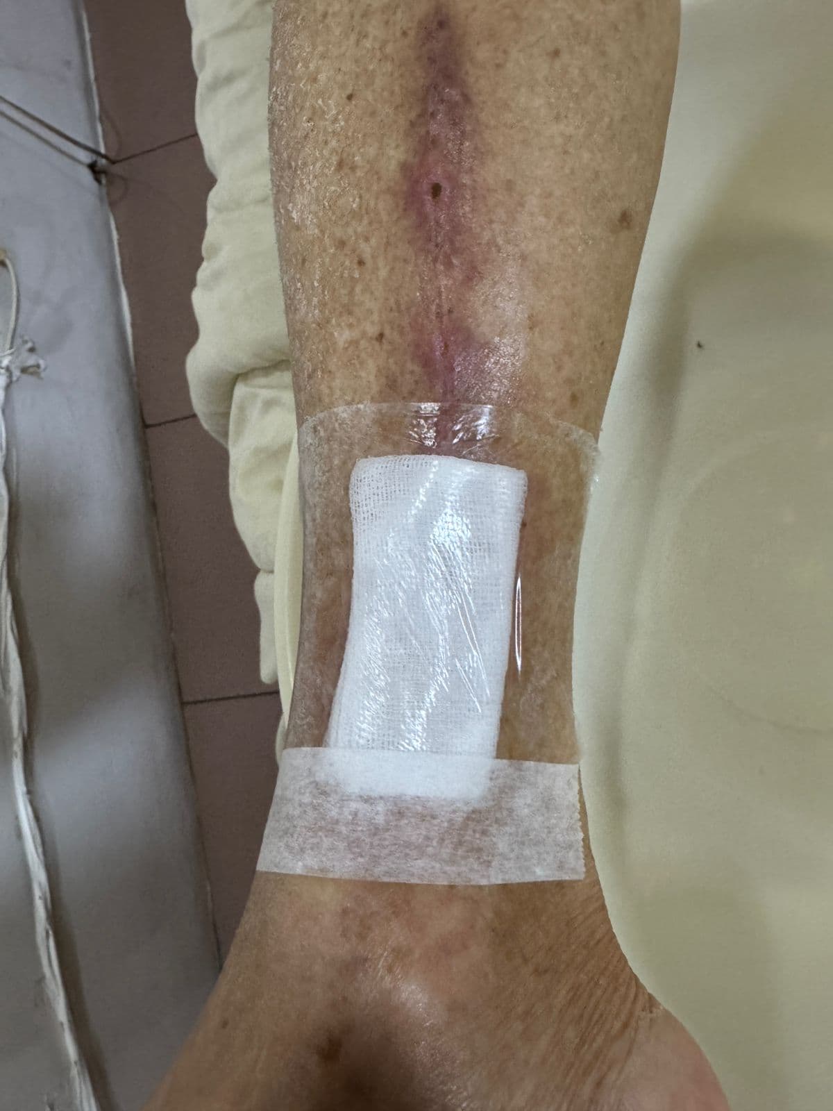 Pengobatan hari ke-1